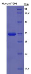 Recombinant Integrin Beta 3 By SDS-PAGE